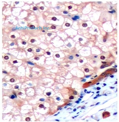 Ki67 Antibody[MA306013]