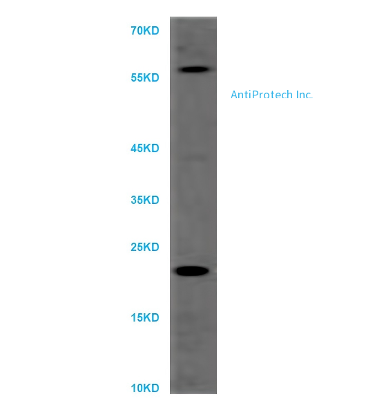 DLK2 Antibody [PA523259]