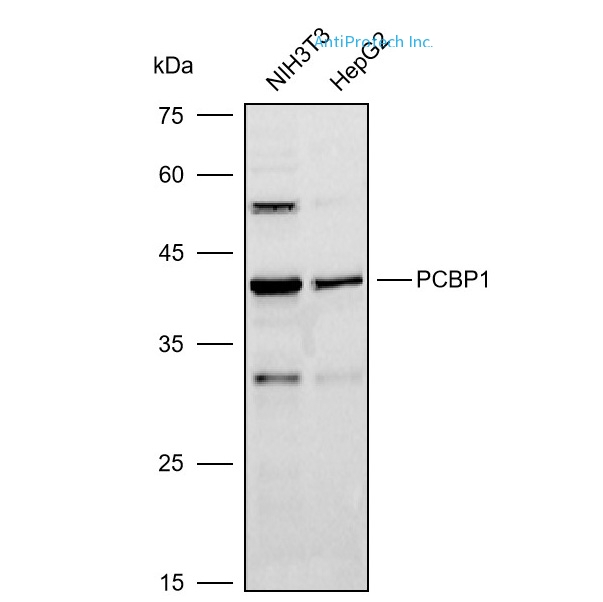 PCBP1 Antibody[PA537955]