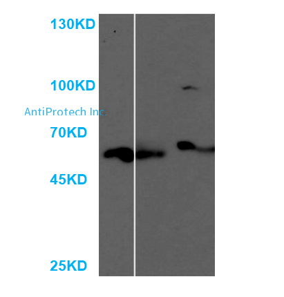 NFKB1  Antibody [PA555356]