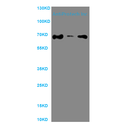 PRICKLE3 Antibody[PA567739]