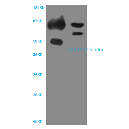 SLC39A4 /ZIP4 Antibody [PA578950]